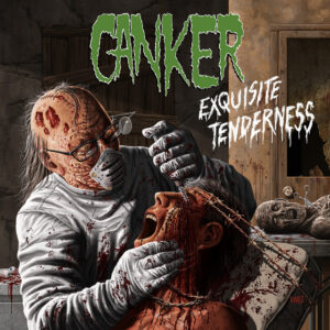 Canker - Exquisite Tenderness