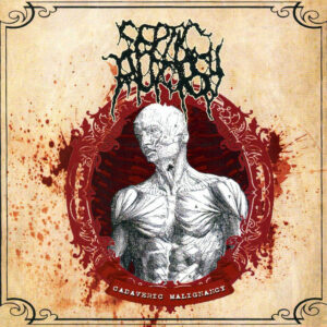 Septic Autopsy – Cadaveric Malignancy (