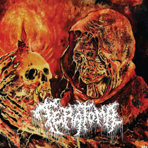 Teratoma - Purulent Manifestations