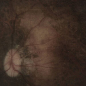 Pale Spektre - Bereft of Xerotic Layers