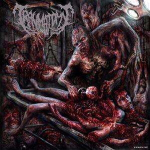 Traumatomy - Beneficialamputation Of Excessive Limbs