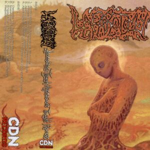 Laparotomy – Ascendancy Through Hypnagogic Thought Process