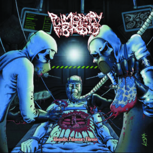 Pulmonary Fibrosis - Idiopathic Pulmonary Fibrosis (Importado Rottenrollrex)